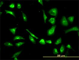 CPVL antibody (ab57383) used in immunofluorescence at 10ug/ml on HeLa cells.