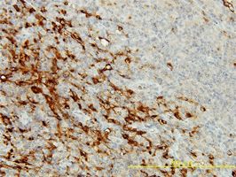 CPVL antibody (ab57383) used in immunohistochemistry at 2ug/ml on formalin fixed and paraffin embedded human lymphomar tissue.