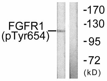 All lanes : Anti-FGFR1 (phospho Y654) antibody (ab59194) at 1/500 dilutionLane 1 : 293 cell extract treated with insulin (0.01U/ml, 15 mins)Lane 2 : 293 cell extract treated with insulin (0.01U/ml, 15 mins) with immunizing phosphopeptide 
