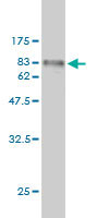 Western blot against tagged recombinant protein immunogen using ab56930 FGFR1OP antibody at 1ug/ml.