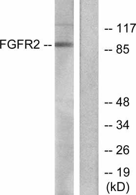 All lanes : Anti-FGFR2 antibody (ab52246) at 1/300 dilutionLane 1 : A549 cell extract; without peptideLane 2 : A549 cell extract; with peptide