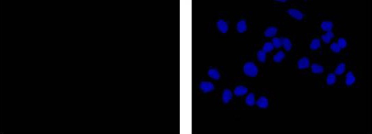 Immunocytochemistry/Immunofluorescence analysis of untreated MCF-7 cells labelling FGFR3 (phospho Y724) with unpurified ab155960 at 1/300. Cells were fixed with 4% paraformaldehyde. An Alexa Fluor® 555-conjugated goat anti-rabbit IgG (1/200) was used as the secondary antibody. Counterstained with DAPI (blue).