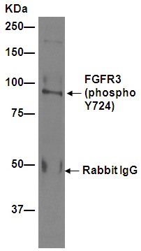 ab155960 (unpurified) at 1/15 immunoprecipitating FGFR3 (phospho Y724) in MCF-7 cells treated with pervanadate. For western blotting, a peroxidase-conjugated goat anti-rabbit IgG (H+L) was used as the secondary antibody (1/1000).Blocking buffer and concentration: 5% NFDM/TBST.Diluting buffer and concentration: 5% NFDM /TBST.
