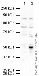 All lanes : Anti-FGFR3 antibody (ab64190) at 1 µg/mlLane 1 : HeLa (Human epithelial carcinoma cell line) Whole Cell LysateLane 2 : SW480 (Human colon adenocarcinoma cell line) Whole Cell Lysate (ab3957)Lysates/proteins at 10 µg per lane.SecondaryGoat polyclonal to Rabbit IgG - H&L - Pre-Adsorbed (HRP) at 1/3000 dilutionPerformed under reducing conditions.
