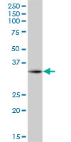Anti-CPXCR1 antibody (ab169651) at 1/500 dilution + Huma liver lysate at 50 µgdeveloped using the ECL technique