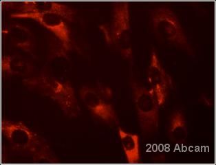 ab44971 (1/50) detecting fibroblast cells (red). Human BJ fibroblast cells were fixed in formaldehyde, permeabilized in 0.1% Triton and blocked in 8% BSA.