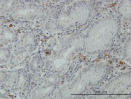 FGL2 antibody (ab56794) used in immunohistochemistry at 5ug/ml on formalin fixed and paraffin embedded human stomach.