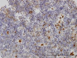 FGR antibody (ab58228) used in immunohistochemistry at 3ug/ml on formalin fixed and paraffin embedded human lymph node.