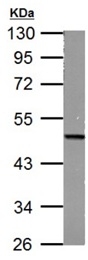 Anti-FH antibody (ab191367) at 1/1000 dilution + mouse liver lysate at 50 µg