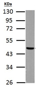 Anti-FH antibody (ab191367) at 1/5000 dilution + rat liver tissue lysate at 50 µg