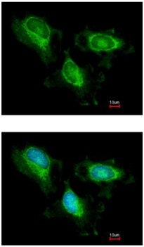 Immunofluorescence analysis of methanol-fixed HeLa cells labeling FH using ab191367 at 1/200 dilution. Bottom image shows Hoechst 33342 counterstain.