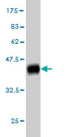 Western blot against tagged recombinant protein immunogen using ab57621 CPXM antibody at 1ug/ml.
