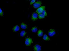 Immunofluorescence analysis of, -20 °C acetone-fixed, HeLa cells labeling FH with ab184945 at a 1/100 dilution. As secondary antibody goat anti-rabbit IgG (Alexa Fluor®488) was used at a 1/200. In blue DAPI staining.