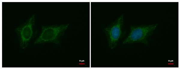 Immunofluorescent analysis of HeLa cells fixed in 4% paraformaldehyde at RT for 5 min, labeling FH with ab184644 at 1/500 dilution (green). Hoechst 33342 staining (blue).