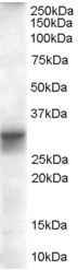 Anti-FHL1 antibody (ab26072) at 0.1 µg/ml