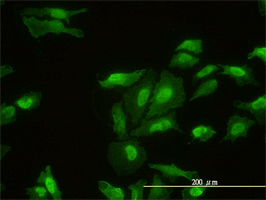 FHL2 antibody (ab58069) used in immunofluorescence at 1-5ug/ml on HeLa cells.