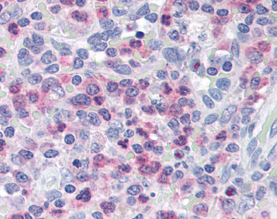 ab78226, at a concentration of 2.5 µg/ml, staining FHL3 in formalin fixed paraffin embedded human spleen tissue by Immunohistochemistry.