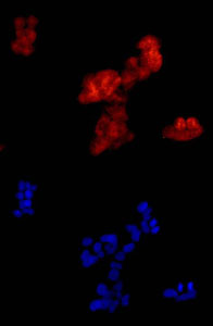 Immunofluorescence analysis of A673 cells labeling FHL3 with ab180509 at 1/100 dilution. Secondary ab: Goat anti rabbit IgG (Alexa Fluor® 555) at 1/250 dilution. Fixative: 4% paraformaldehyde. Counter stain: Dapi