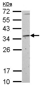 Anti-Fibrillarin antibody (ab153862) at 1/1000 dilution + Rat2 whole cell lysate at 30 µg