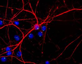 Rat neurons and glial stained with mouse monoclonal to Fibrillarin (green) and with chicken antibody to neurofilament NF-H (red). Cells were counterstained with a fluorescent DNA probe (blue). Nuclear DNA is revealed with Hoechst dye (blue). Cultures were processed using our standard fixation and staining procedure (in protocol section). 