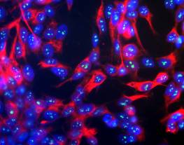 Human neuroblastoma line SH-SY5Y stained with mouse monoclonal to Fibrillarin (green) and with chicken antibody to neurofilament NF-H (red) and counterstained with a fluorescent DNA probe (blue). Nuclear DNA is revealed with Hoechst dye (blue). The NF-H antibody was used at a dilution of 1/100000 and the fibrillarin monoclonal at 1/1000. Cultures were processed using standard fixation and staining procedure (in protocol section). 