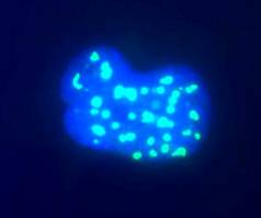 High magnification view of human Hek293 cell nuclei stained with mouse monoclonal to fibrillarin (green), counterstained with a fluorescent DNA probe (blue). Nuclear DNA is revealed with Hoechst dye (blue). Cultures were processed using our standard fixation and staining procedure (in protocol section).