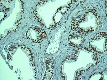 Immunohistochemical analysis of paraffin-embedded Human prostate tissue labeling Fibrillarin with ab154806 at 1/250 dilution.