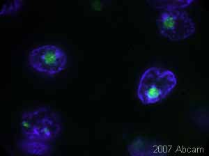 ab5821 staining human liver tissue sections by IHC-P.  Sections were formaldehyde fixed, permeabilized in Triton-X and subjected to heat mediated antigen retrieval prior to blocking with 6% BSA for 2 hours at 23°C. The primary antibody was diluted 1/100 and incubated with the sample for 16 hours at 5°C.  ab6717 was used as the secondary antibody.See Abreview