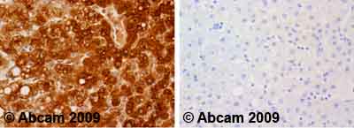 Ab34269 staining human liver. Staining is localized to the cytoplasm.Left panel: with primary antibody at 1 ug/ml. Right panel: isotype control.Sections were stained using an automated system (Dako PT Link), at room temperature. Sections were rehydrated and antigen retrieved with the Dako 3-in-1 antigen retrieval buffer, citrate pH 6.0. Slides were peroxidase blocked in 3% H2O2 in methanol for 10 minutes. They were then blocked with Dako Protein block for 10 minutes (containing casein 0.25% in PBS) then incubated with primary antibody for 20 minutes and detected with Dako Envision Flex amplification kit for 30 minutes. Colorimetric detection was completed with diaminobenzidine for 5 minutes. Slides were counterstained with Haematoxylin and coverslipped under DePeX. Please note that for manual staining we recommend to optimize the primary antibody concentration and incubation time (overnight incubation), and amplification may be required.