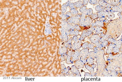 ab34269 staining Fibrinogen in Human liver/placenta tissue by Immunohistochemistry (Formalin/PFA-fixed paraffin-embedded tissue sections). The sections were fixed in formaldehyde and subjected to heat-mediated antigen retrieval in citrate buffer, pH 6.0 for 20 minutes at 100°C. The primary antibody was diluted 1/2000 and incubated with the sample for 20 minutes at 25°C. An HRP polymer-conjugated mouse anti-rabbit polyclonal IgG was used as the secondary antibody.See Abreview