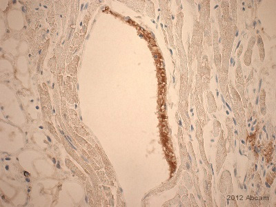 Immunohistochemical analysis of rat heart, staining Fibrinogen with ab34269.Tissue was fixed with formaldehyde and blocked with 0.25% BSA for 15 minutes at room temperature; antigen retrieval was by heat mediation in citrate buffer. Samples were incubated with primary antibody (1.5 µg/ml in 1% BSA in TBS) for 20 minutes. An undiluted HRP-conjugated goat anti-rabbit polyclonal IgG was used as the secondary antibody.See Abreview