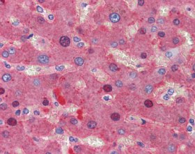 ab110062 at 1/200 staining Fibrinopeptide B in Formalin-Fixed, Paraffin-Embedded Human Liver, after heat induced antigen retrieval in pH 6.0 citrate buffer, by Immunohistochemistry. Sections were incubation with biotinylated secondary antibody, followed by alkaline phosphatase-streptavidin and chromogen.
