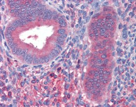 ab110062 at 1/200 staining Fibrinopeptide B in Formalin-Fixed, Paraffin-Embedded Human Uterus, after heat induced antigen retrieval in pH 6.0 citrate buffer, by Immunohistochemistry. Sections were incubation with biotinylated secondary antibody, followed by alkaline phosphatase-streptavidin and chromogen.