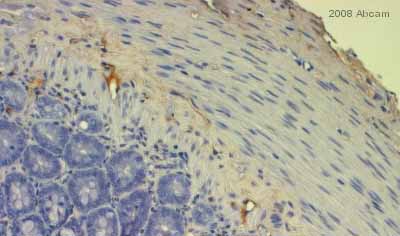 ab23751 staining rat intestine tissue section by immunohistochemistry (Formalin/PFA-fixed, paraffin-embbeded sections). Tissue underwent fixation in Bouins solution and processed by enzyme mediated antigen retrieval method. The primary antibody was diluted 1/500 and incubated with sample for 1 hour at 20°C. A HRP-conjugated mouse polyclonal to rabbit IgG was used undiluted as the secondary.See Abreview