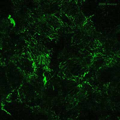 ab6328 staining human arterial endothelial cells by ICC/IF.  Cells were PFA fixed, permeabilized with 0.05% Triton X-100 and blocked with 0.2% BSA for 1 hour at 25°C  The primary antibody was diluted 1/200 and incubated with the sample for 1 hour at 25°C.  An Alexa Fluor® 488 conjugated donkey anti-mouse antibody, diluted 1/400, was used as the secondary.See Abreview
