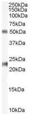 Anti-Fibulin 5 antibody (ab53515) at 0.1 µg/ml + Human Ovary lysate (35µg protein in RIPA buffer).