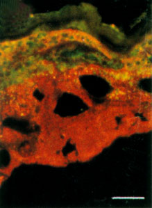 ab24584 at a 1/1000 dilution staining the upper layers of the mouse developing epidermis (green) but not the periderm by Immunohistochemistry (frozen sections). Periderm is visualised by Texas Red-labled antibody to K14. Areas containing epitopes recognized by both K14 and the other antibody stain yellow or orange (scale bar = 15um). 