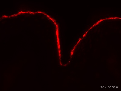 ab3137 staining Filaggrin in Human skin tissue by Immunohistochemistry (Frozen sections). Tissue was fixed with paraformaldehyde, blocked with 1% BSA for 30 minutes at 25°C and permeabilized with 0.2% Triton X-100. Samples were incubated with primary antibody (1/200 in diluent) for 1 hour. An AlexaFluor®594-conjugated goat anti-mouse IgG polyclonal (1/1000) was used as the secondary antibody. See Abreview
