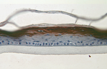 Immunohistochemical analysis of cultured Human keratinocytes isolated from neonatal foreskin, staining Filaggrin with ab3137. Antigen retrieval was performed via heat mediation in citrate buffer, blocked in 3% BSA for 20 min, before incubating with primary antibody overnight at 4°C.
