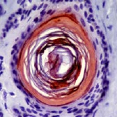 ab18098 staining human Filaggrin in human skin by Immunohistochemistry (FFPE-sections).