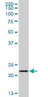 Anti-FKBP11 antibody (ab68087) at 1/500 dilution + human pancreas at 25 µgSecondaryGoat Anti-Mouse IgG (H&L)-HRP Conjugate at 1/2500 dilution