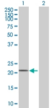 All lanes : Anti-FKBP11 antibody (ab68087) at 1/500 dilutionLane 1 : FKBP11 transfected 293T cell lysateLane 2 : Non transfected 293T cell lysateLysates/proteins at 25 µg per lane.SecondaryGoat Anti-Mouse IgG (H&L)-HRP Conjugate at 1/2500 dilution