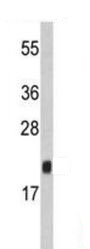 Anti-FKBP11 antibody - N-terminal (ab190101) at 1/1000 dilution + Mouse stomach lysate at 35 µg