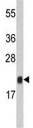 Anti-FKBP11 antibody - N-terminal (ab175570) at 1/1000 dilution + mouse stomach tissue lysates at 35 µg
