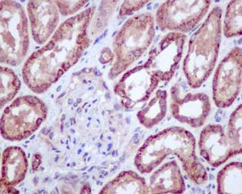 Immunohistochemical analysis of paraffin-embedded, Human kidney tissue labeling CRABP2 with ab181255 at a 1/100 dilution. Counter stained with hematoxylin.