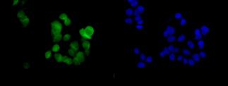Immunofluorescence analysis of, paraformaldehyde-fixed, MCF7 cells labeling CRABP2 with ab181255 at a 1/250 dilution. As secondary antibody Goat anti rabbit IgG (Alexa Fluor®488) (green) was used at a 1/200 dilution. DAPI staining in blue.