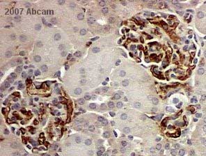 ab14432 at 1/1000 staining mouse liver tissue sections by IHC-P. The tissue sections were paraformaldehyde fixed and blocked prior to incubation with the ab14432 for 24 hours. An HRP conjugated secondary antibody was used. The image shows staining in liver cells of a female mouse at 20X magnification.See Abreview
