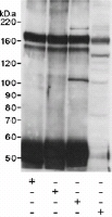 Antibodies: ab14432, ab14433 and ab14434 used at 2 mcg/mg extract for IP. FKBP135 in NE and immunoprecipitated FKBP135 were detected using ab14434 at 0.2 mcg/ml. Detection: Chemiluminescence with an exposure time of 10 minutes.