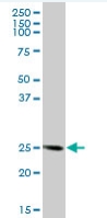Anti-FKBP14 antibody (ab68091) at 1/500 dilution + human kidneys at 25 µgSecondaryGoat Anti-Mouse IgG (H&L)-HRP Conjugate at 1/2500 dilution