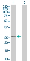 All lanes : Anti-FKBP14 antibody (ab68091) at 1/500 dilutionLane 1 : FKBP14 transfected 293T cell lysateLane 2 : non transfected 293T cell lysateLysates/proteins at 25 µg per lane.SecondaryGoat Anti-Mouse IgG (H&L)-HRP Conjugate at 1/2500 dilution